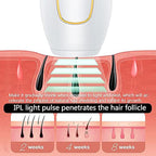 Depiladora Láser IPL - Color Mix