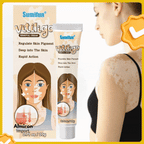 SUMIFUN VITILIGO CREMA ELIMINADORA 20g